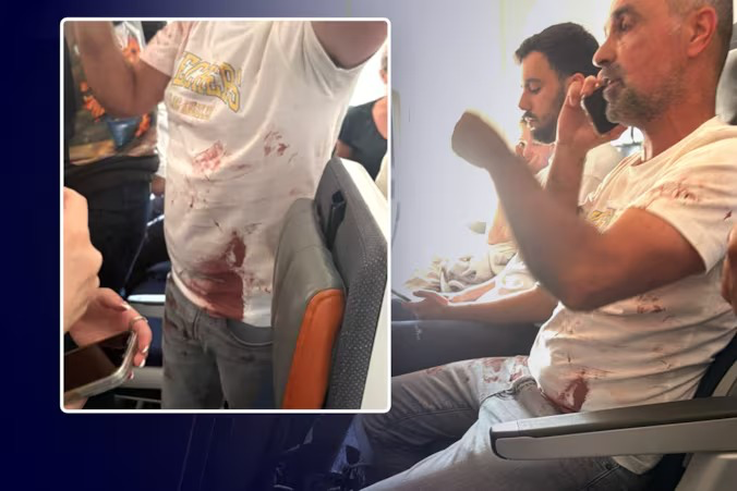 Passenger in a blood-stained T-shirt on board the Flydubai flight; inset shows a blood-stained shirt close up